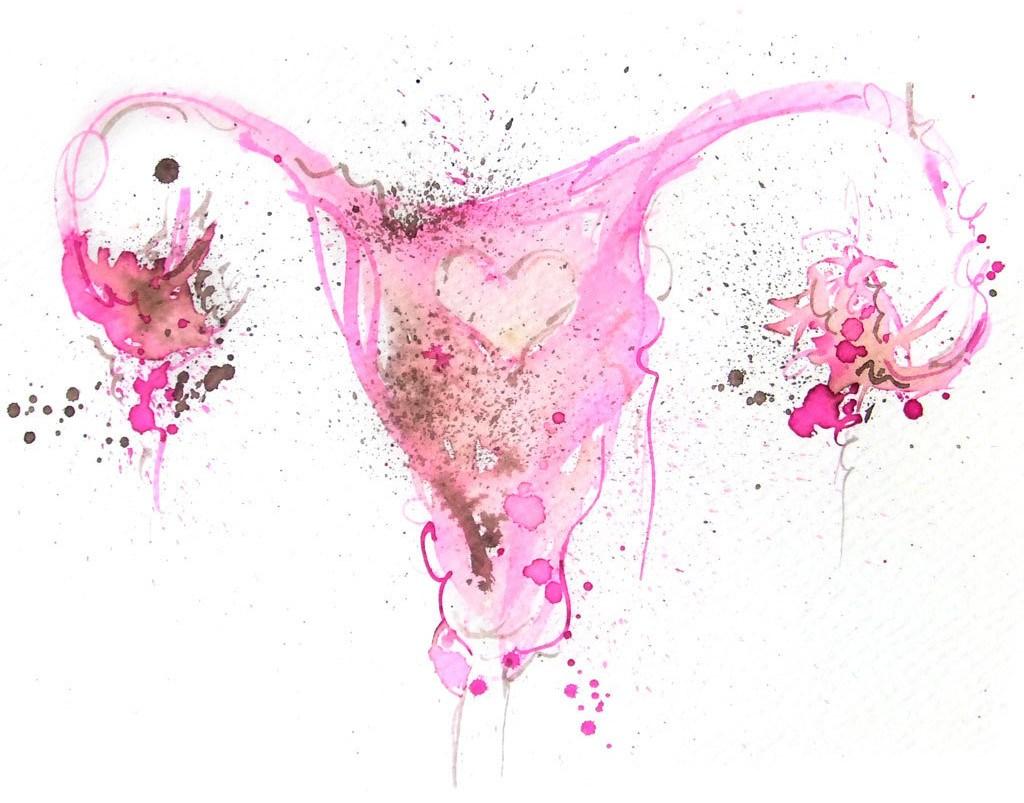 Endometriosis: Symptoms, Management and Treatment