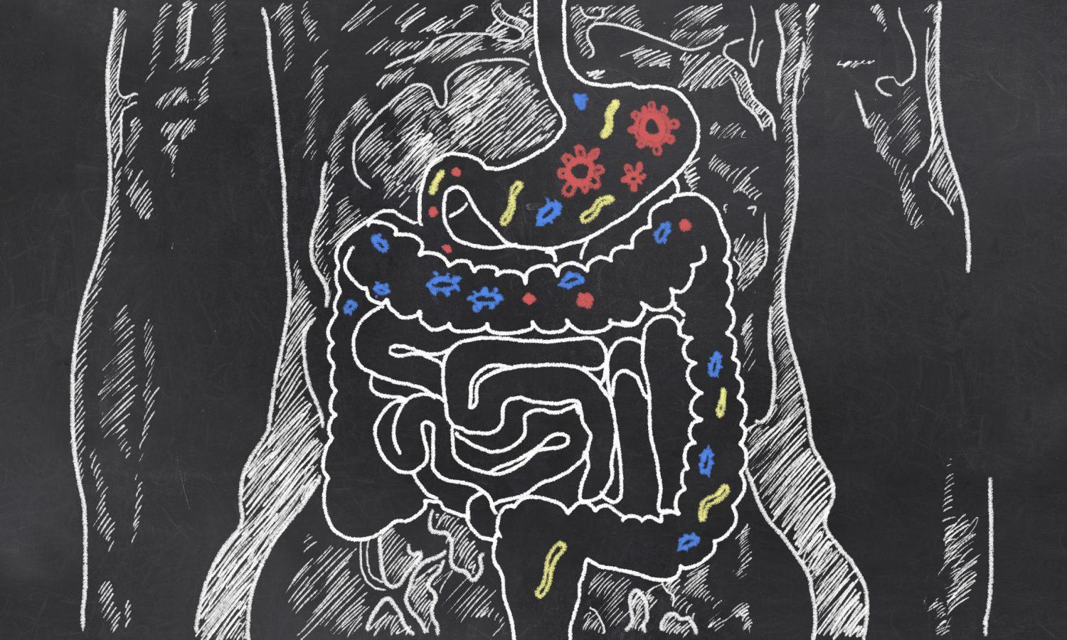 Do You Have Leaky Gut?