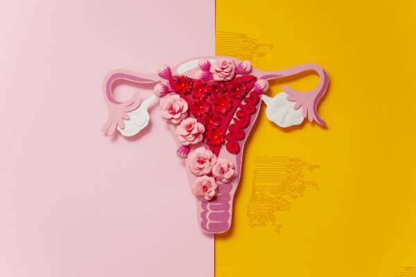A Naturopathic Guide to Endometriosis